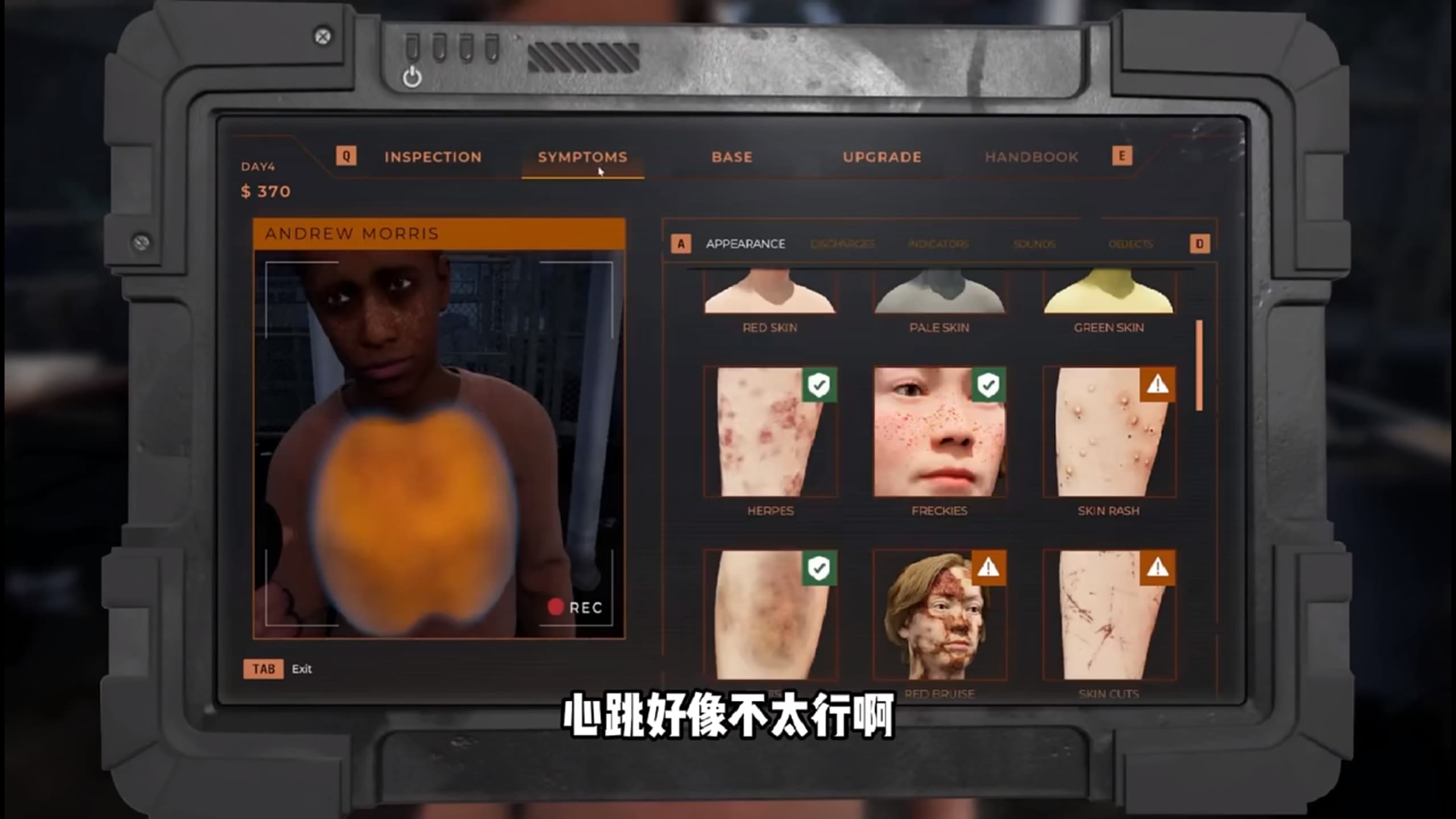 边境丧尸检察[图3]